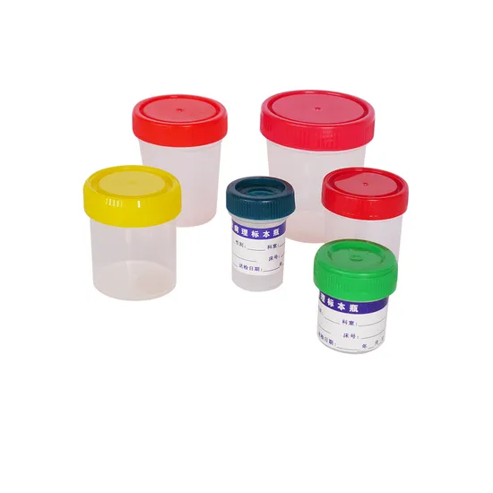 고품질 OEM ODM 실험실 기기 가격 혈액 분석기 페트리 접시 표본 용기